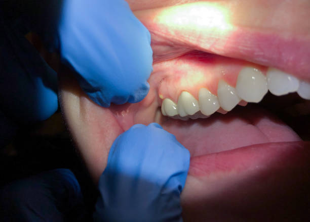 Best Urgent Dental Care for Toothaches in Vinco, PA